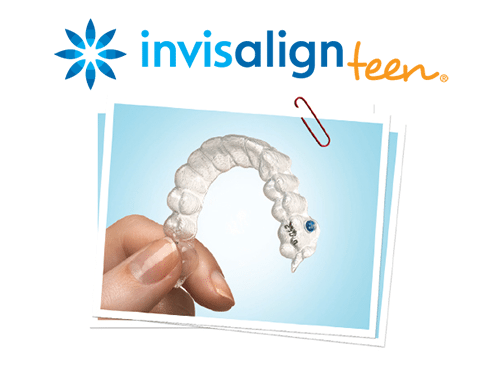 Invisalign Braces - Priority Dental Group